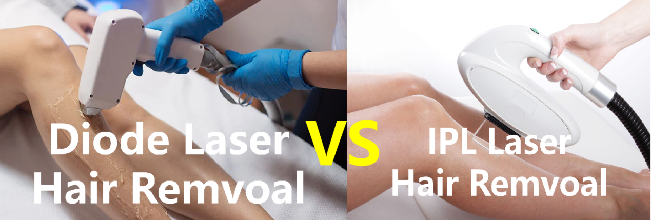 IPL VS DIOD LASER HÅRBORTTAGNING