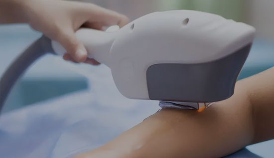 IPL lasermaskin