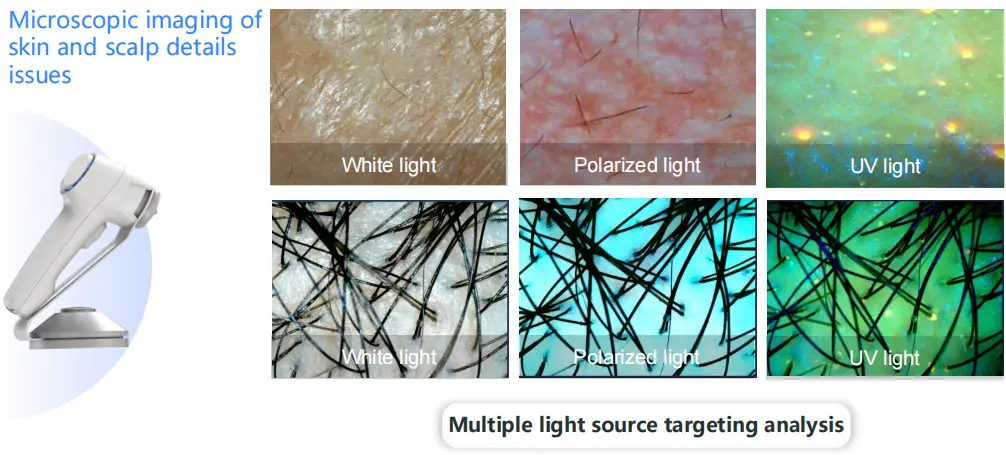 2 In 1 Professional Skin Analysis With Hair Scalp Detection